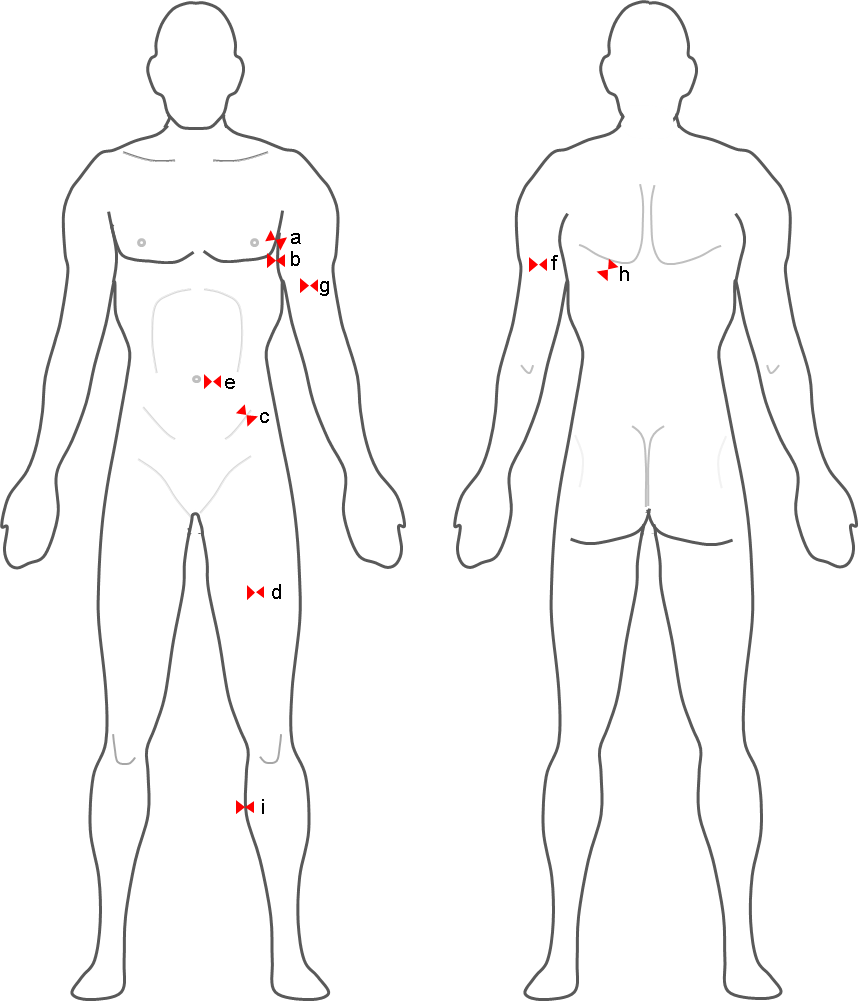 Skinfold measurement vs