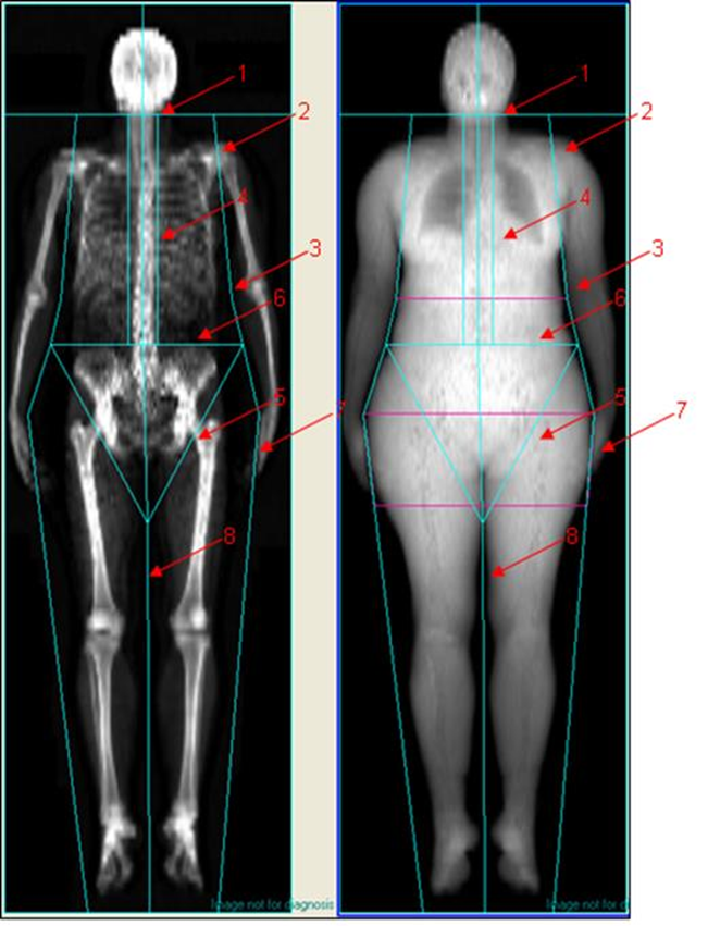 What Does A DEXA Scan Show Me? - Bodyscan UK