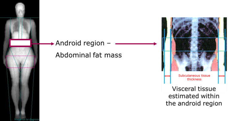 https://www.measurement-toolkit.org/images/anthropometry/dexa12.png